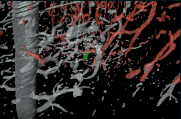 Ein Klick auf das Bild führt zum Film "Sehen heißt Verstehen". Er zeigt neben einer 3D-Animation dieses Bildes weitere Momentaufnahmen des Lebens, die zu wichtigen Entdeckungen führten und gibt erste Einblicke in das geplante Imaging Technology Centre. Bi